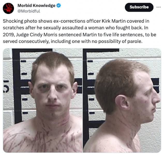 Unsettling Realities: Facts That Leave A Lasting Impression