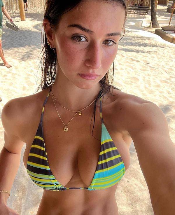 the charm of freckled faces 44 pics 5.html - 44 HD Photos | Premium Gallery 2024