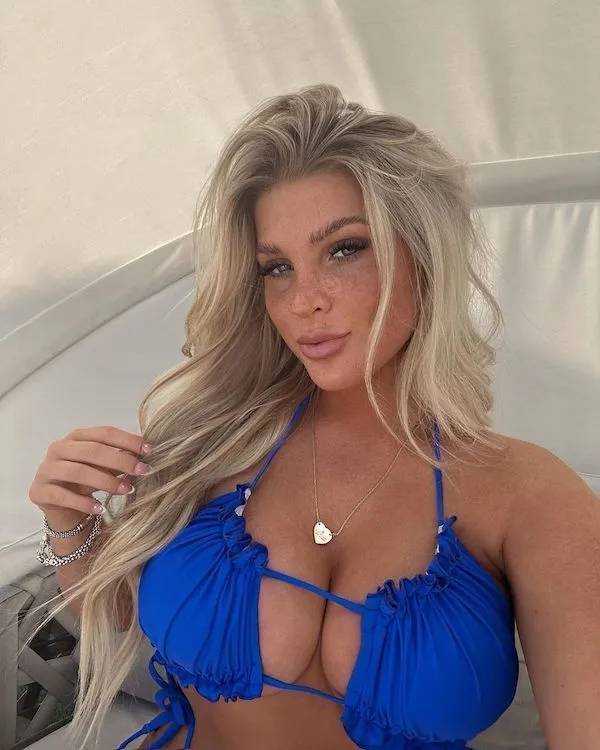 the charm of freckled faces 44 pics 5.html - 44 HD Photos | Premium Gallery 2024