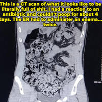 tongues out 36 pics 27.html - 36 HD Photos | Premium Gallery 2022