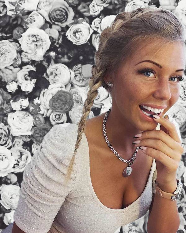 the charm of freckled faces 51 pics 6.html - 51 HD Photos | Premium Gallery 2024