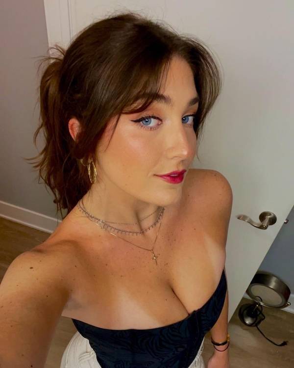 the charm of freckled faces 49 pics 5.html - 49 HD Photos | Premium Gallery 2024