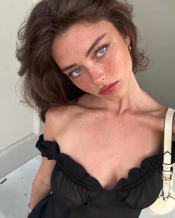 The Charm Of Freckled Faces