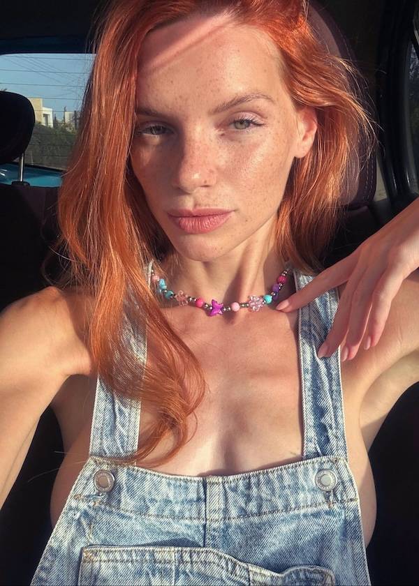 The Charm Of Freckled Faces