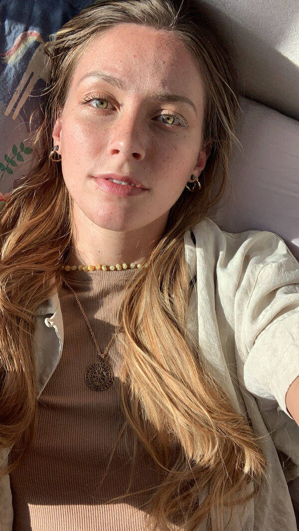 The Charm Of Freckled Faces