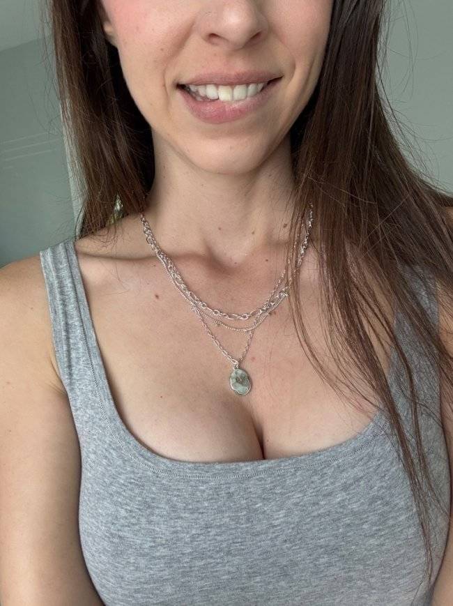 The Charm Of Freckled Faces