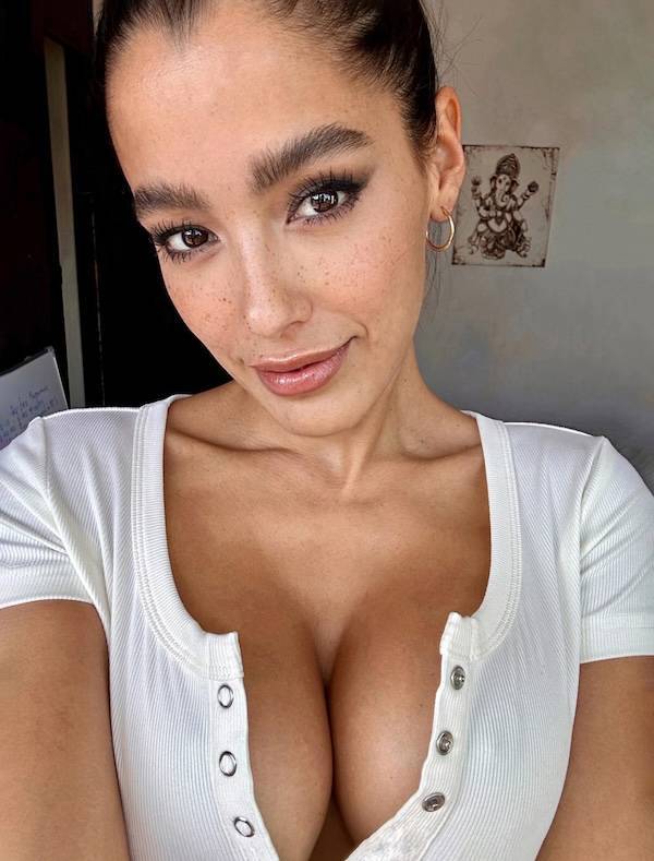 The Charm Of Freckled Faces