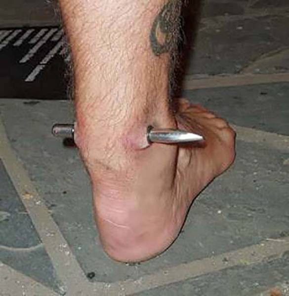 People, Never Get This Far In Body Modifications!