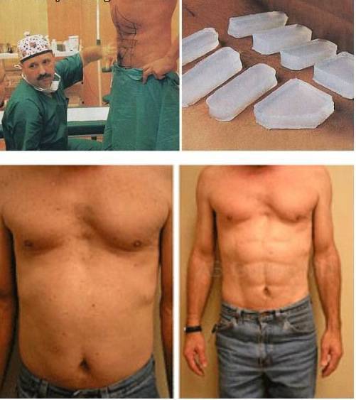 People, Never Get This Far In Body Modifications!