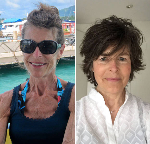 Anorexia Is Not The Final Verdict!