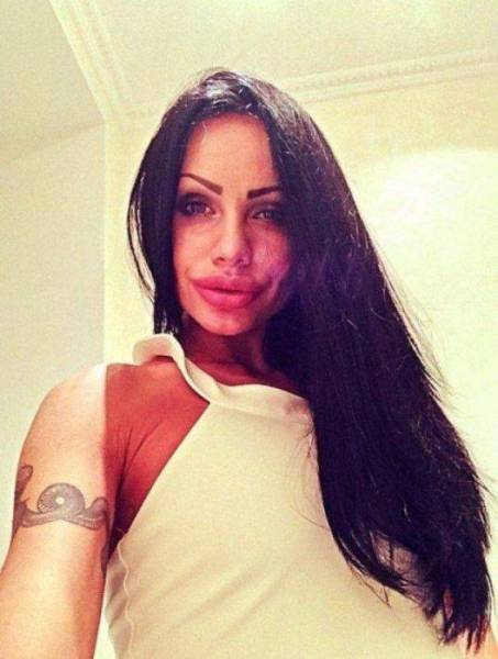 For Them, Lips Are Never Big Enough…