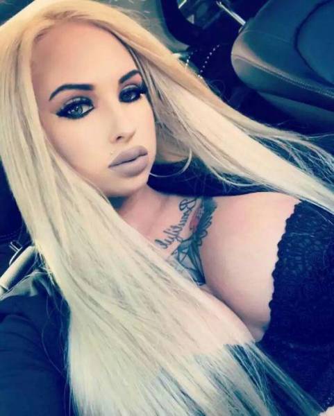 For Them, Lips Are Never Big Enough…