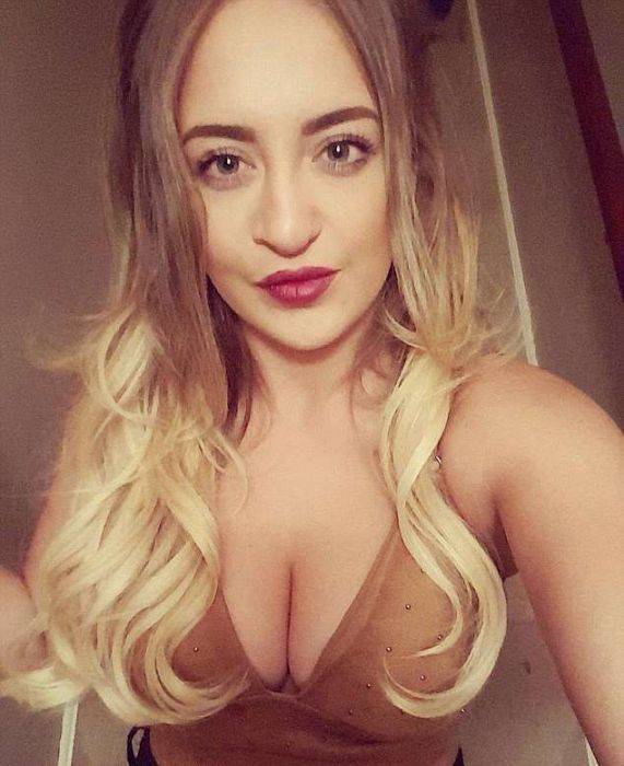 Girl With A Wolf Mouth 10 Operations Later…