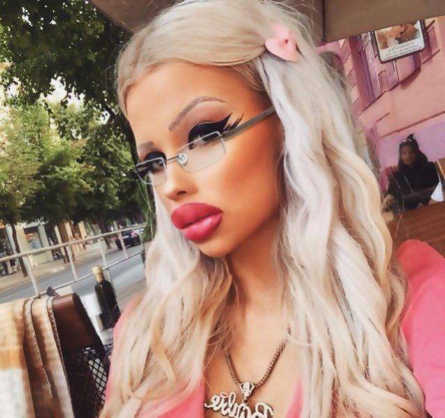 What Have They Done With Their Lips?!