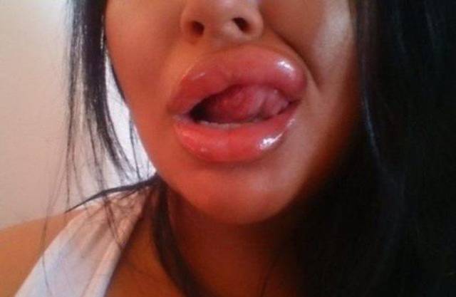 What Have They Done With Their Lips?!