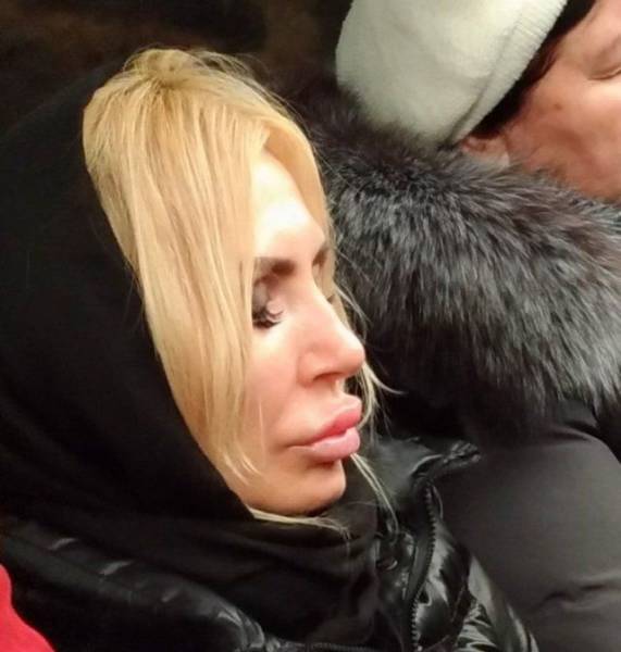 What Have They Done With Their Lips?!