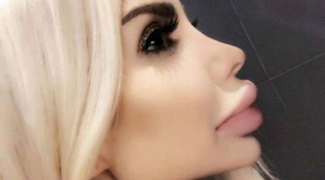 What Have They Done With Their Lips?!