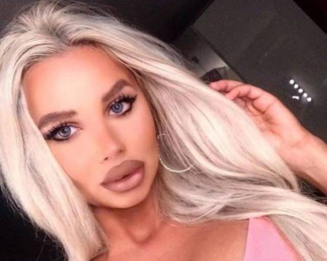 What Have They Done With Their Lips?!