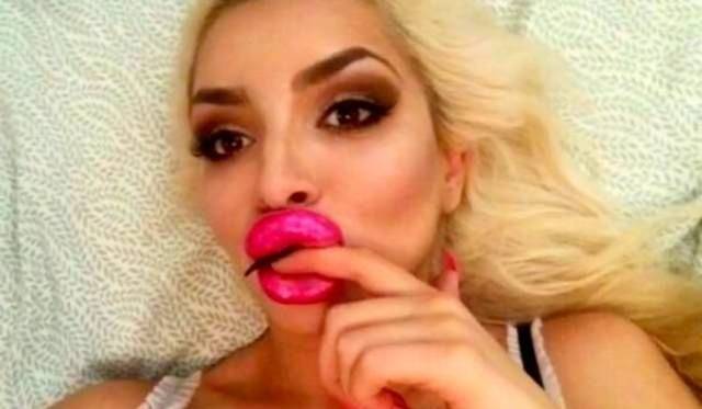 What Have They Done With Their Lips?!