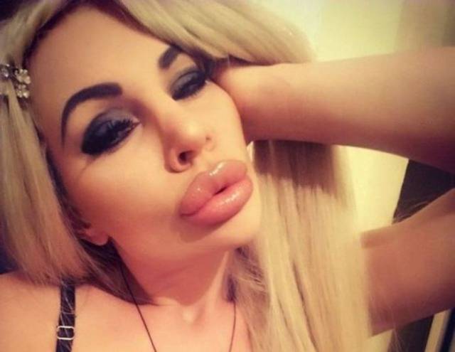 What Have They Done With Their Lips?!