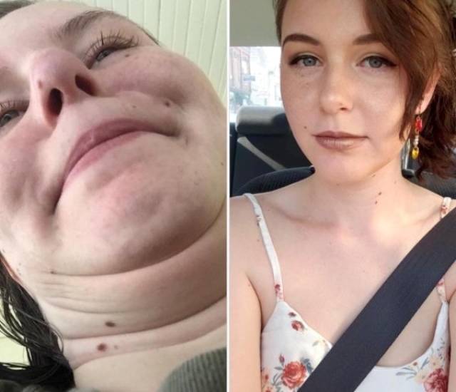 Pretties Go Derp-Mode