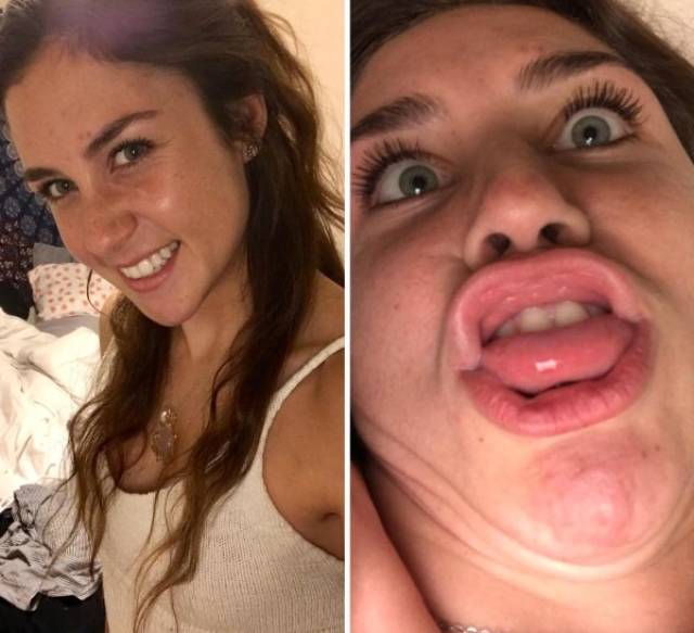 Pretties Go Derp-Mode