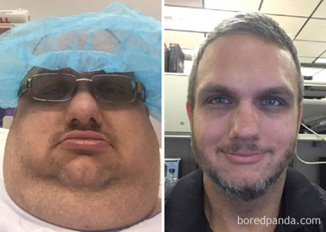 Weight Losses That Are Hard To Believe