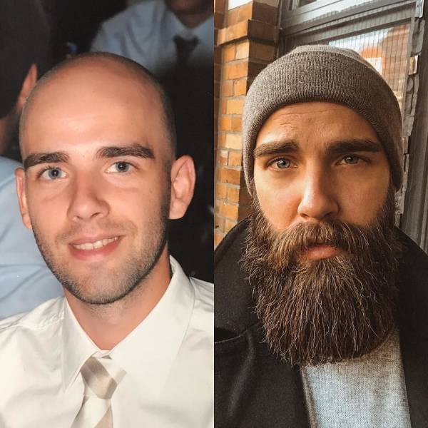 Beards Really Do Matter!