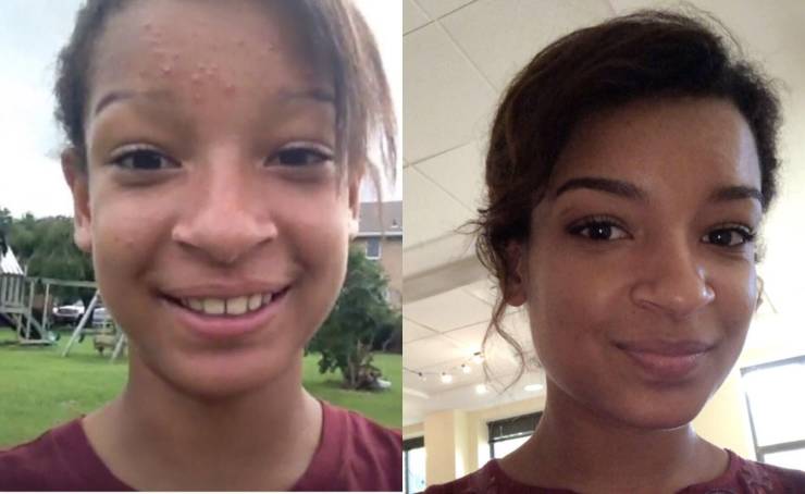 Ugly Duckling? Not Anymore