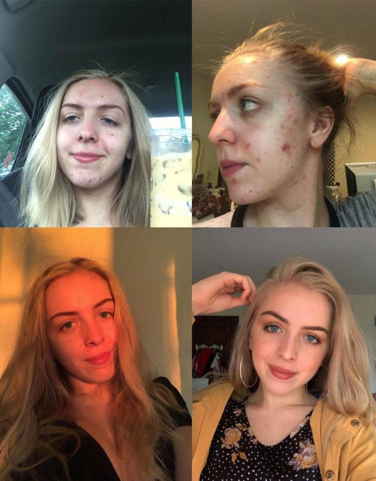 Ugly Duckling? Not Anymore