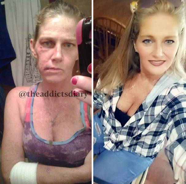 How Drug Addiction Looks Before And After
