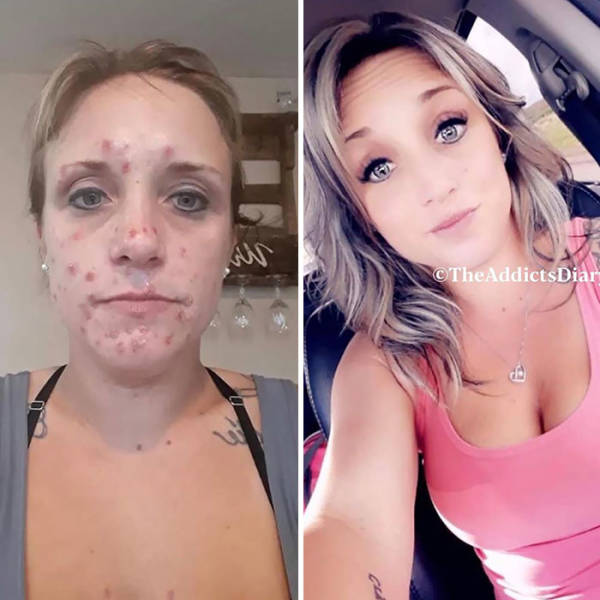 How Drug Addiction Looks Before And After