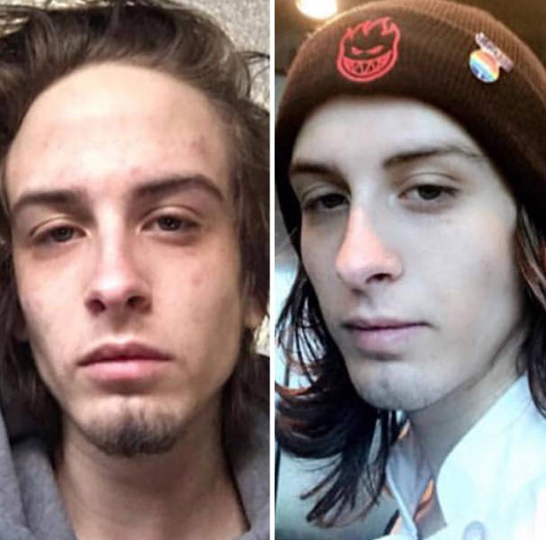 How Drug Addiction Looks Before And After