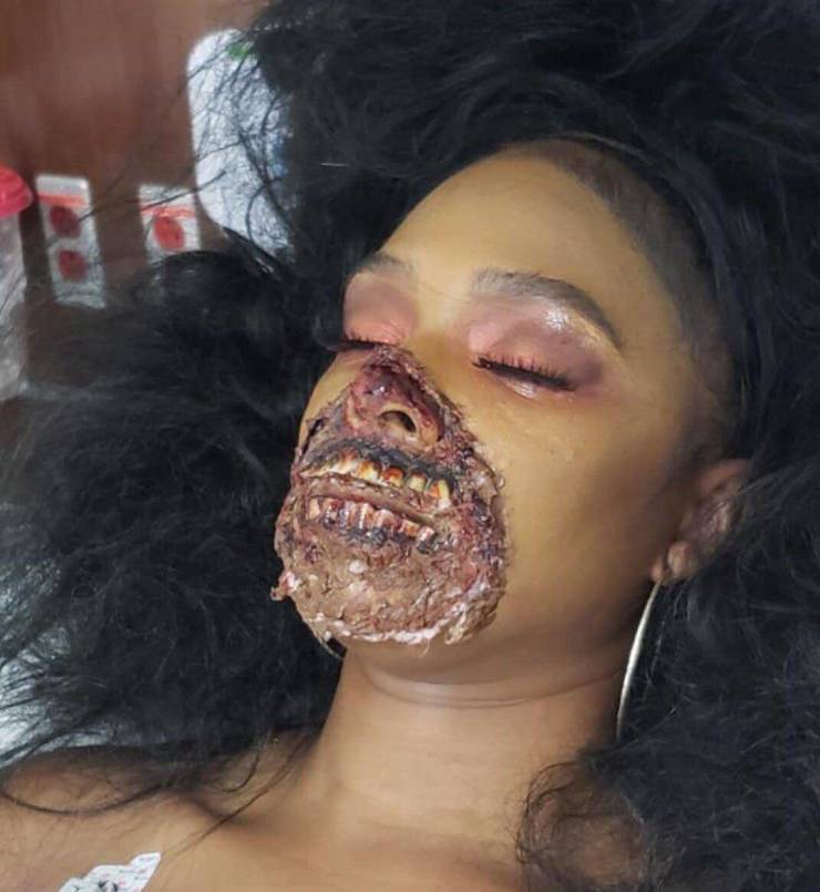 She’s Severely Injured!