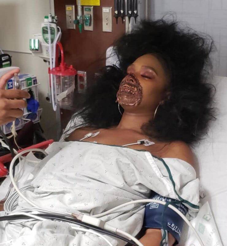 She’s Severely Injured!