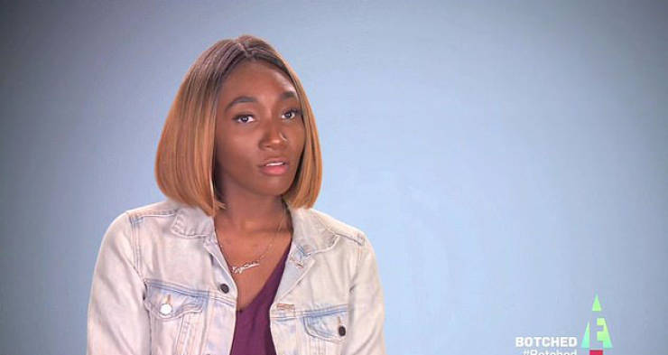 Plastic Surgery Isn’t Always Good For You