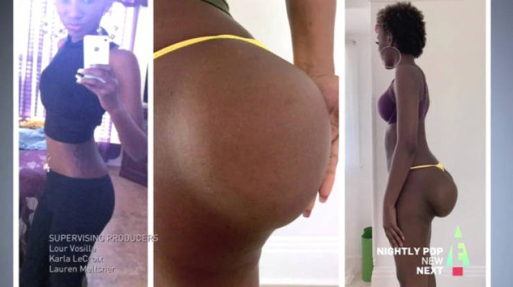 Plastic Surgery Isn’t Always Good For You