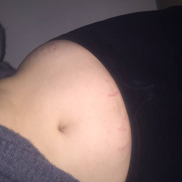 Models Who Are Not Ashamed Of Their Body “Flaws”