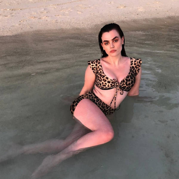 Models Who Are Not Ashamed Of Their Body “Flaws”