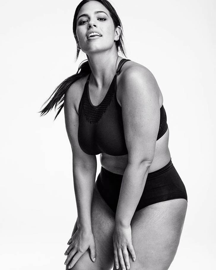 Models Who Are Not Ashamed Of Their Body “Flaws”