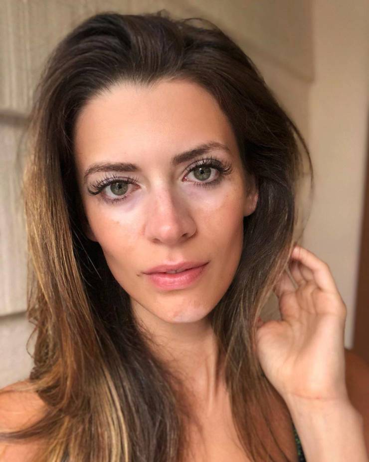 Models Who Are Not Ashamed Of Their Body “Flaws”