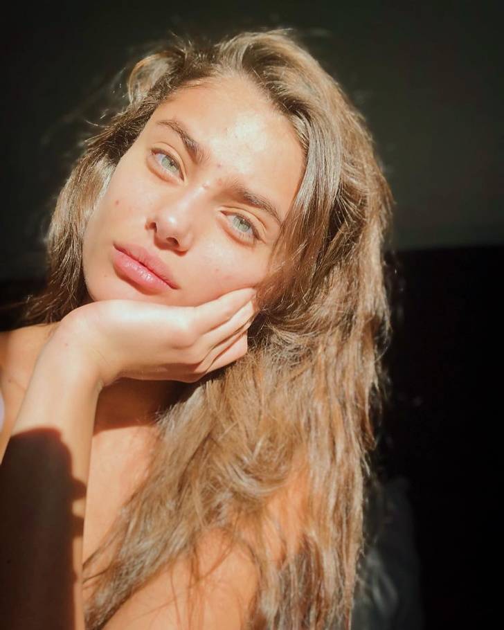 Models Who Are Not Ashamed Of Their Body “Flaws”