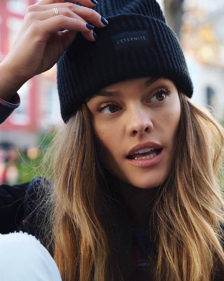 Models Who Are Not Ashamed Of Their Body “Flaws”