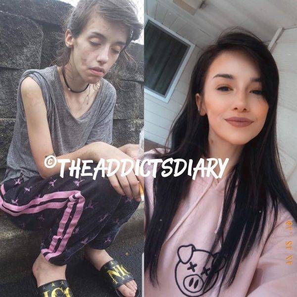 How Drug Addicts Transform After Getting Clean