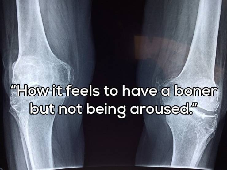 The Opposite Sex Is So Strange!