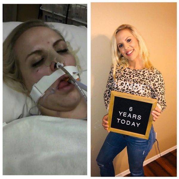 Drug Addicts Have A Chance!