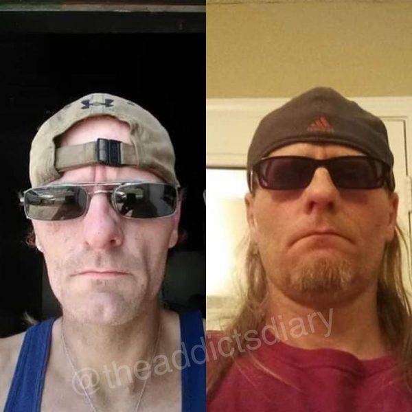 Drug Addicts Have A Chance!