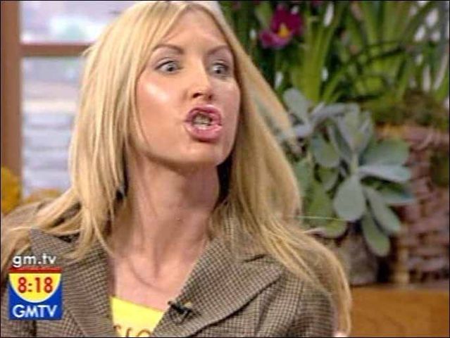 42 shoking celebrity photos of 2008 (33 pics)