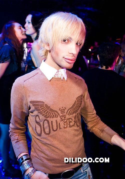 When plastic surgery fails (38 pics)