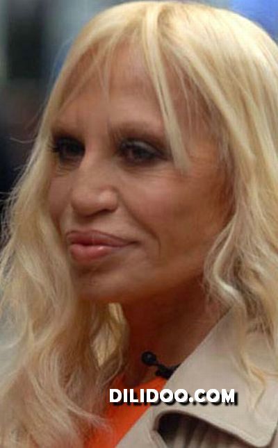 When plastic surgery fails (38 pics)